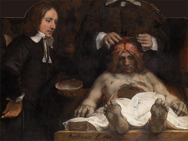 The Anatomy Lesson of Dr Joan Deyman, 1656 | Rembrandt | Gemälde Reproduktion